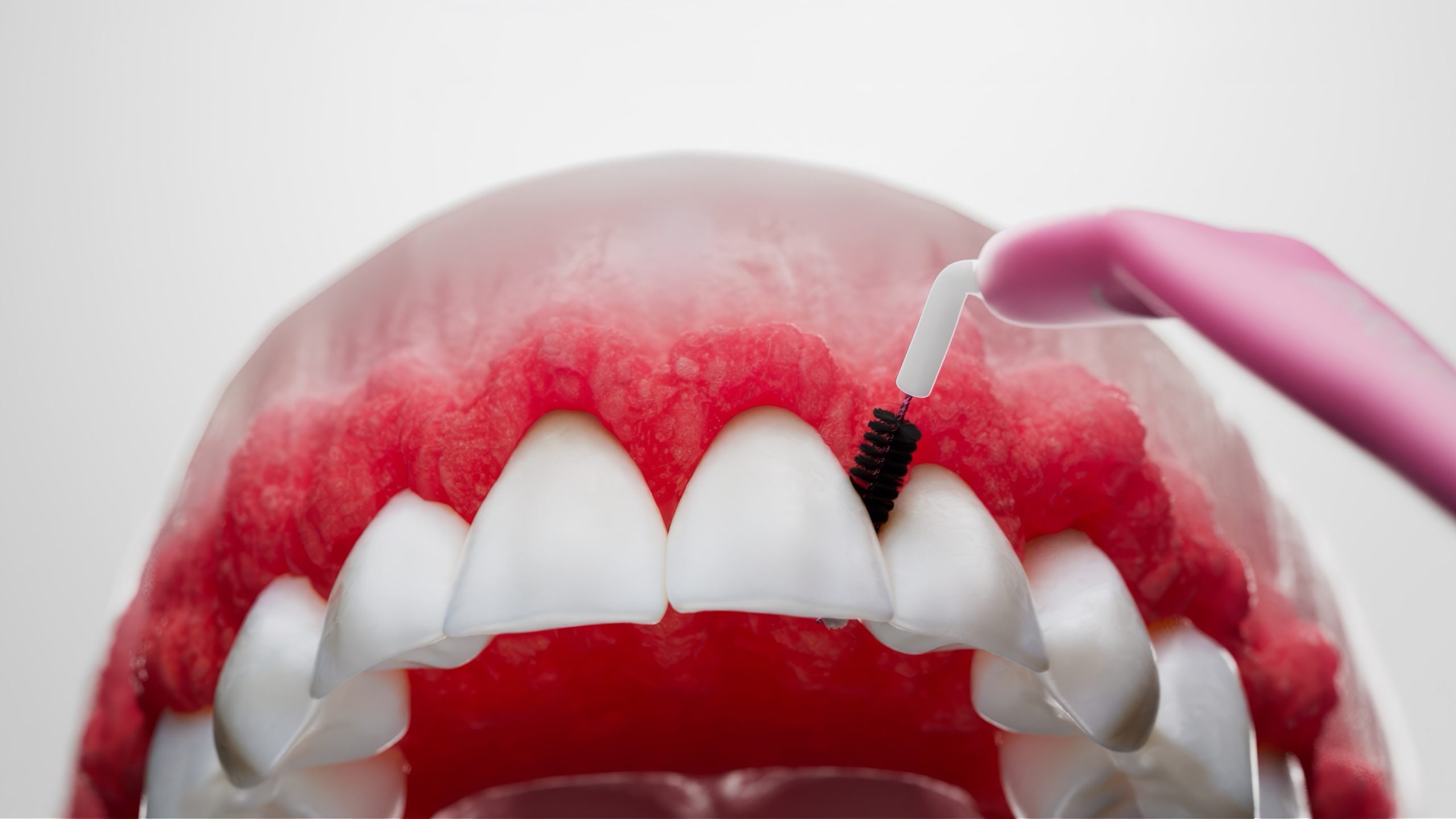 Animations with Interprox Interdental Brushes